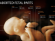 TRAFIC DE FOETUS FRANCE INTERNATIONAL